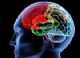 Immagine di Brain Salad